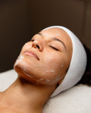 huidverbetering amsterdam - tca peeling