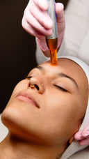 <h1><em>Microneedling</em></h1><h1><em>Amsterdam</em></h1>