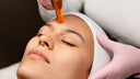 <h1><em>Microneedling</em></h1><h1><em>Amsterdam</em></h1>